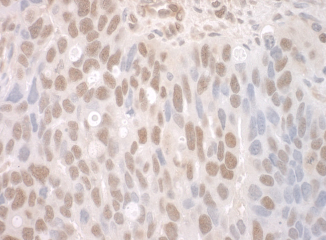 CTNNBL1 Antibody in Immunohistochemistry (Paraffin) (IHC (P))