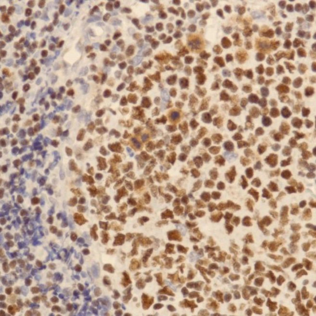 IKAROS Antibody in Immunohistochemistry (IHC)