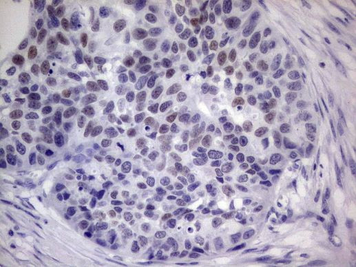 IKZF3 Antibody in Immunohistochemistry (Paraffin) (IHC (P))