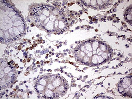 IKZF3 Antibody in Immunohistochemistry (Paraffin) (IHC (P))