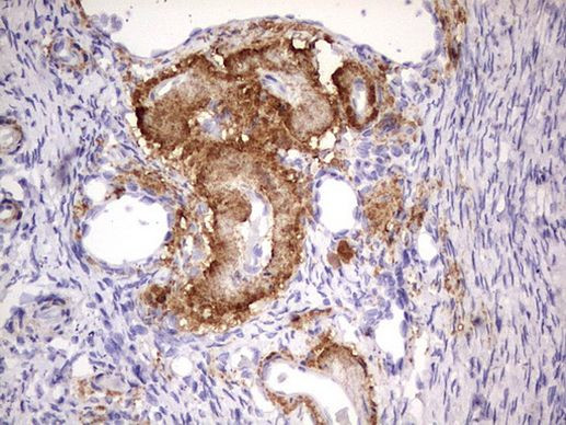 IKZF3 Antibody in Immunohistochemistry (Paraffin) (IHC (P))