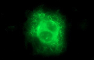 IL10RA Antibody in Immunocytochemistry (ICC/IF)