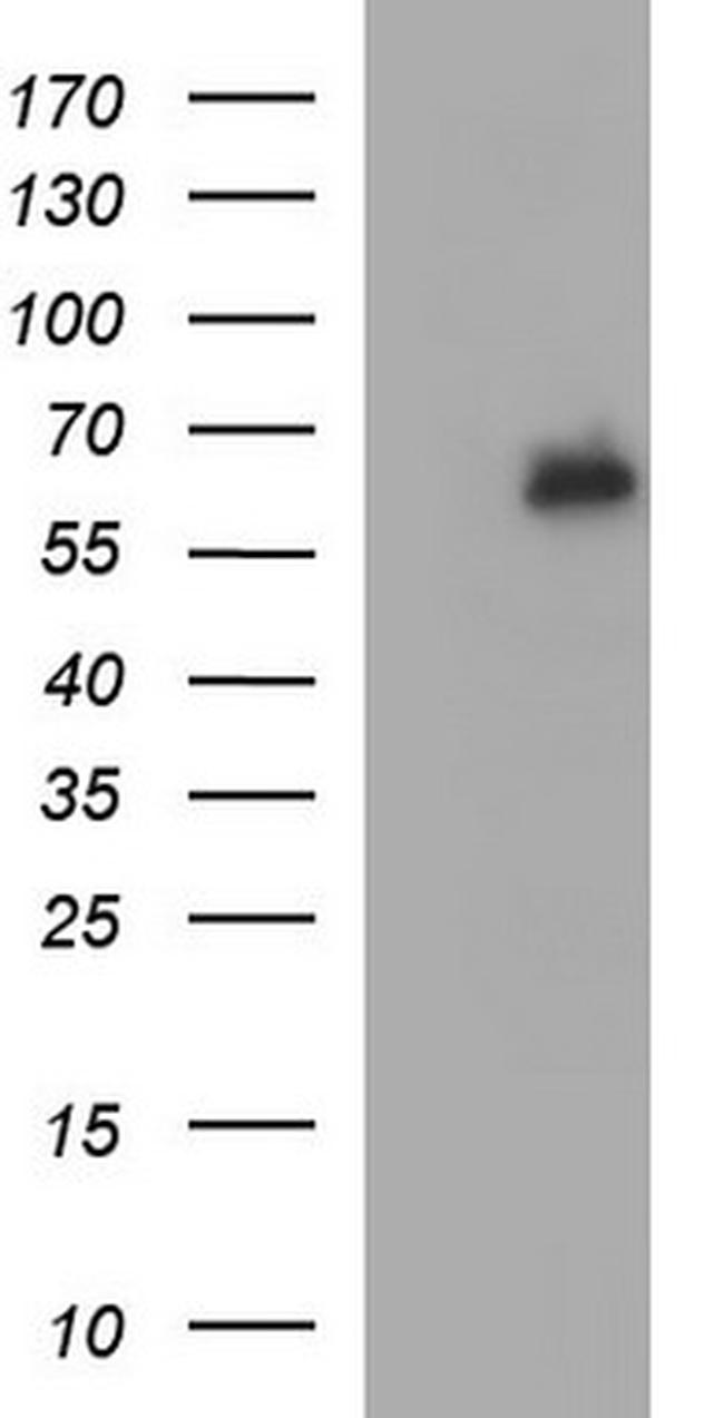IL10RA Antibody in Western Blot (WB)
