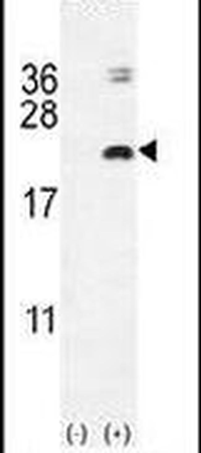 IL-17F Antibody in Western Blot (WB)