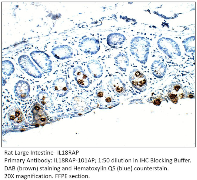 IL18RAP Antibody in Immunohistochemistry (IHC)