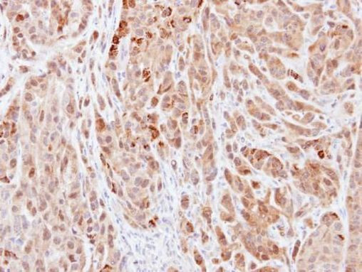 IL-18 Antibody in Immunohistochemistry (Paraffin) (IHC (P))