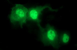 IL1A Antibody in Immunocytochemistry (ICC/IF)