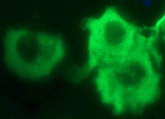 IL1A Antibody in Immunocytochemistry (ICC/IF)