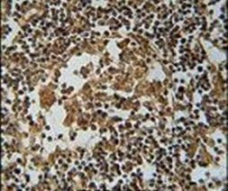 IL1F6 Antibody in Immunohistochemistry (IHC)