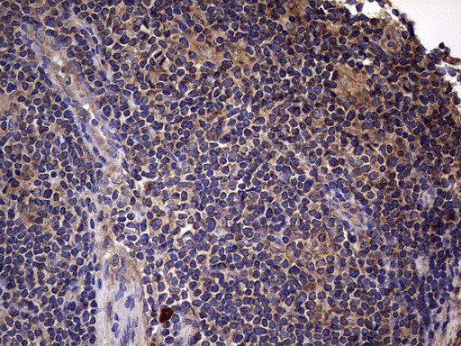IL1RN Antibody in Immunohistochemistry (Paraffin) (IHC (P))