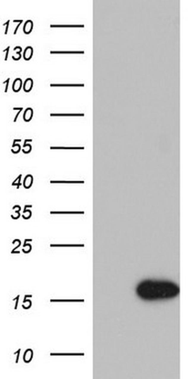 IL1RN Antibody in Western Blot (WB)