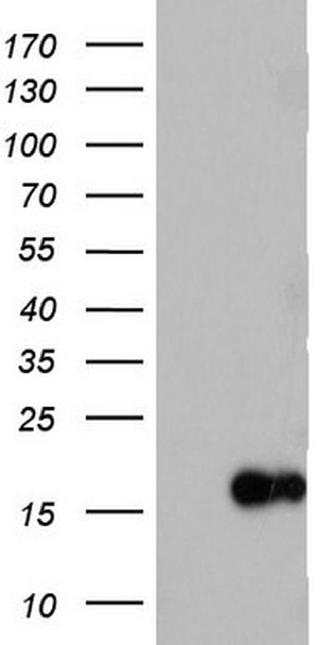IL1RN Antibody in Western Blot (WB)