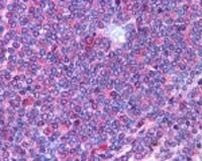 IL23R Antibody in Immunohistochemistry (Paraffin) (IHC (P))