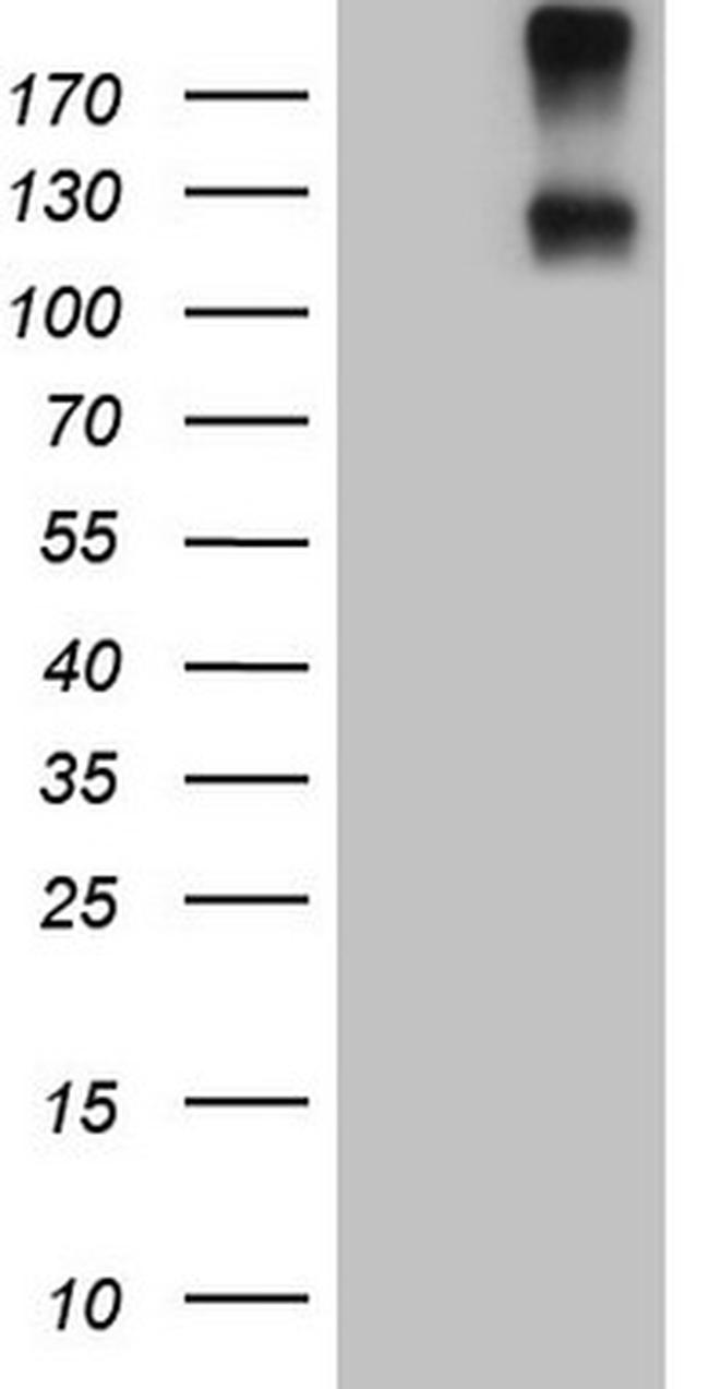IL23R Antibody in Western Blot (WB)