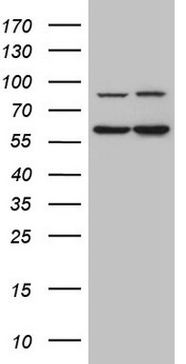 IL23R Antibody in Western Blot (WB)