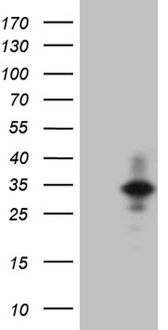 IL24 Antibody in Western Blot (WB)