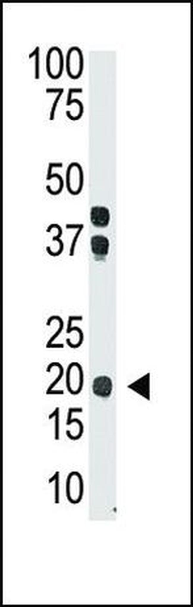 IL-28A Antibody in Western Blot (WB)