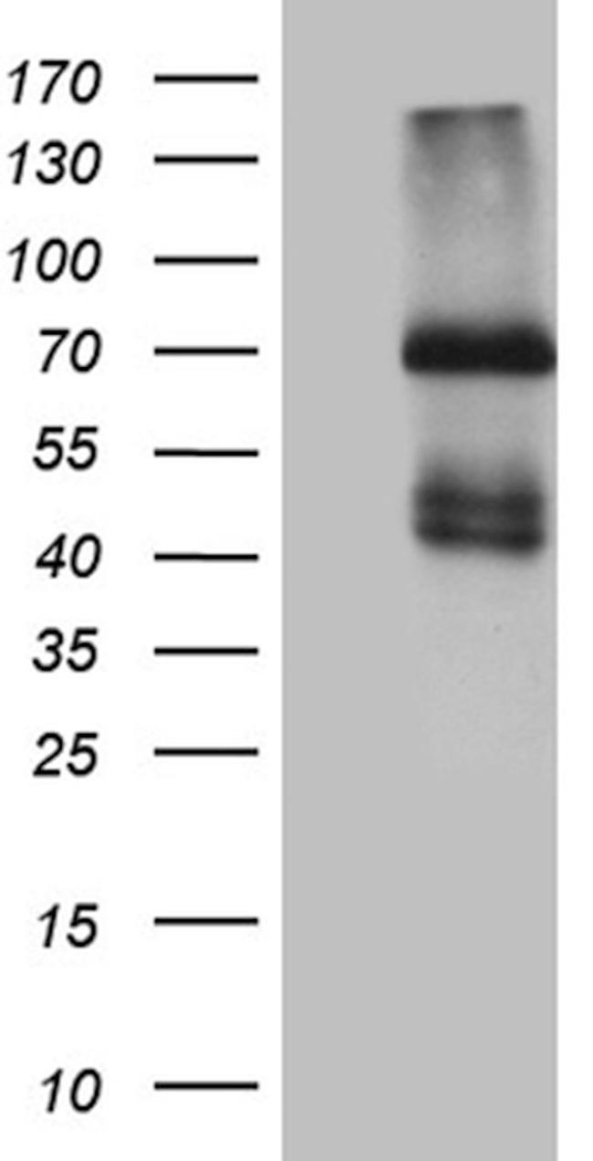 IL2RB Antibody in Western Blot (WB)