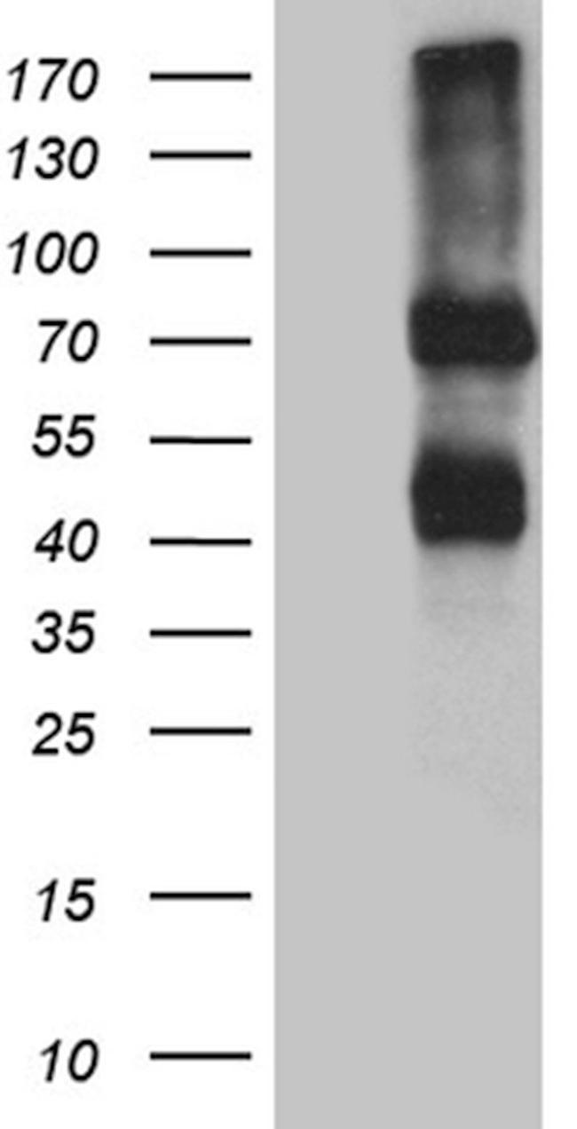 IL2RB Antibody in Western Blot (WB)
