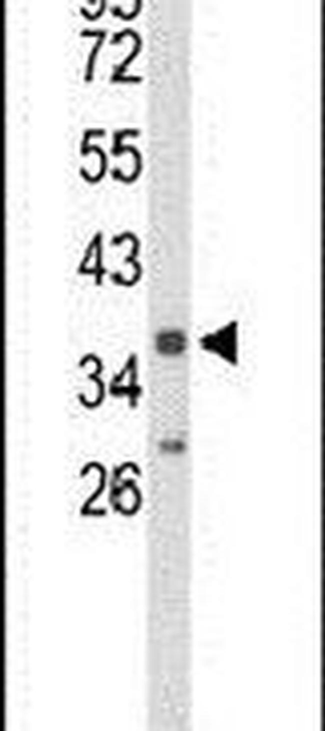 IL2RG Antibody in Western Blot (WB)