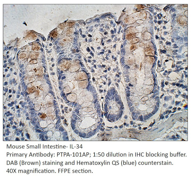 IL-34 Antibody in Immunohistochemistry (IHC)