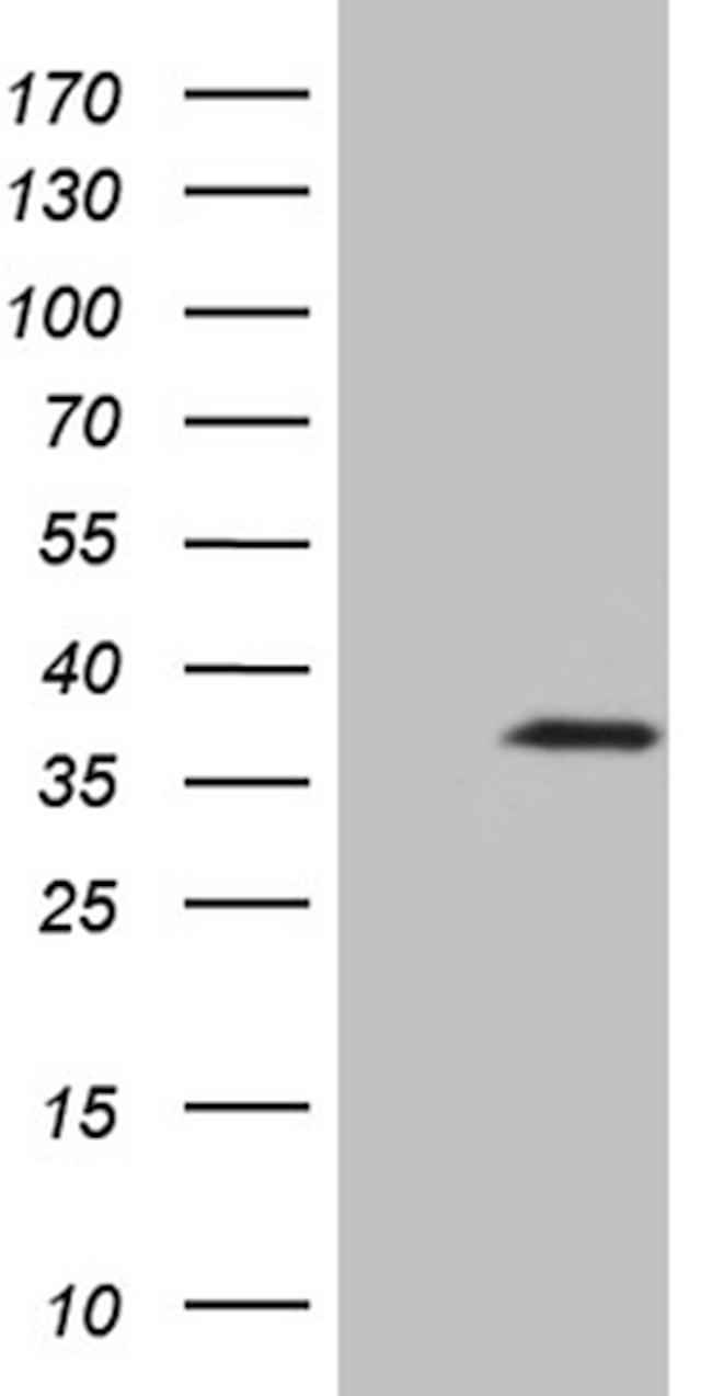IL34 Antibody in Western Blot (WB)