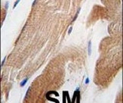 ILK Antibody in Immunohistochemistry (IHC)