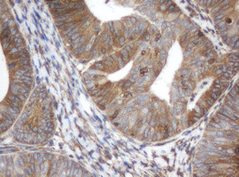 ILVBL Antibody in Immunohistochemistry (Paraffin) (IHC (P))