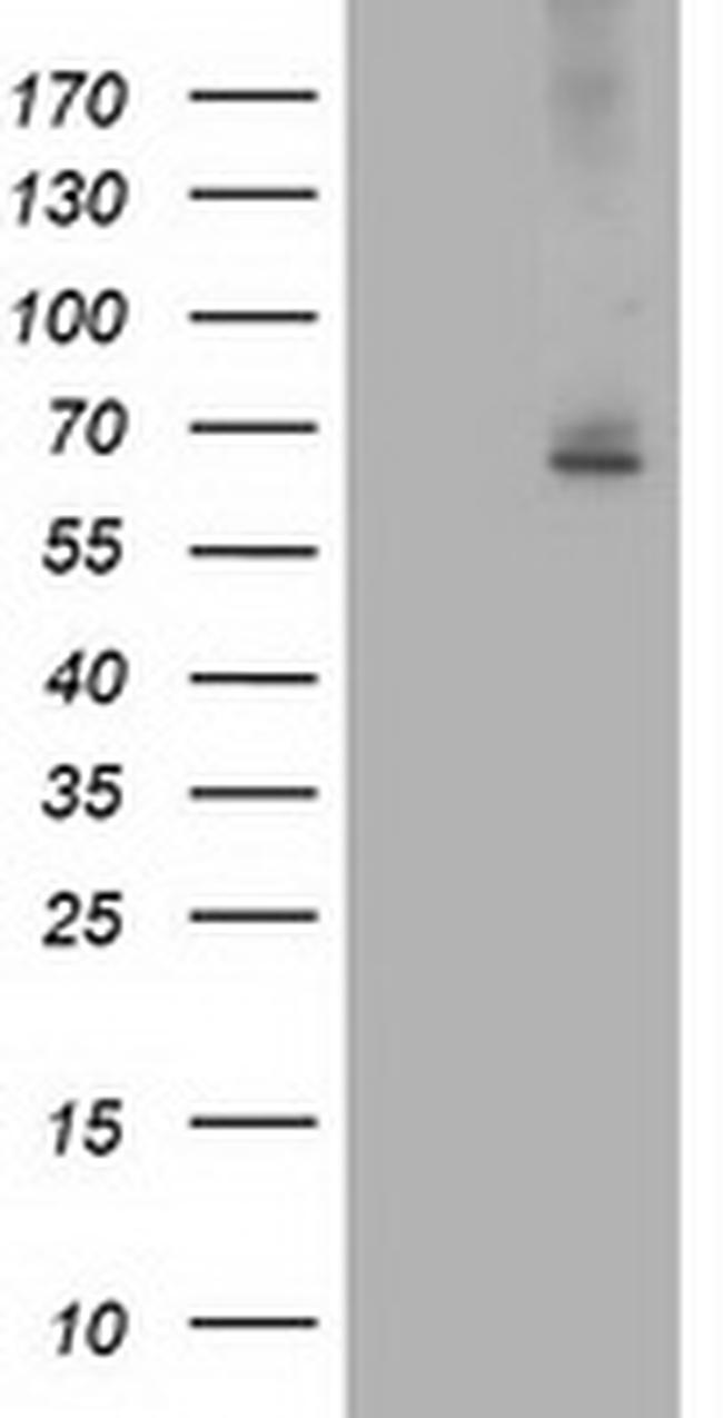 ILVBL Antibody in Western Blot (WB)