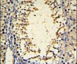IMP3 Antibody in Immunohistochemistry (IHC)