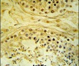 IMP4 Antibody in Immunohistochemistry (IHC)