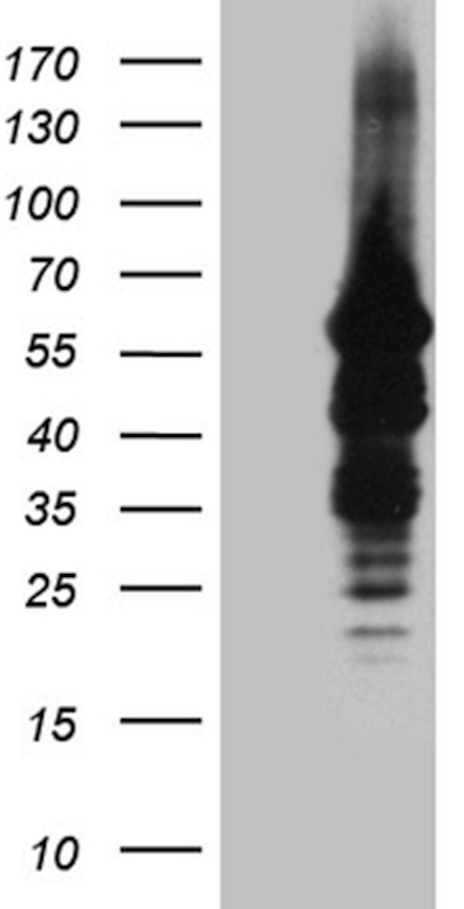 IMPDH2 Antibody in Western Blot (WB)