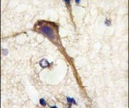 alpha Internexin Antibody in Immunohistochemistry (IHC)