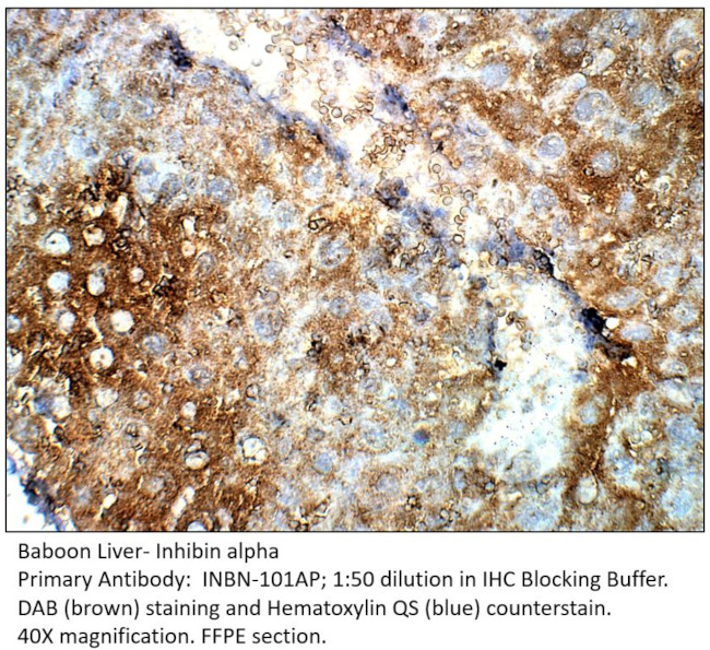 Inhibin alpha Antibody in Immunohistochemistry (IHC)