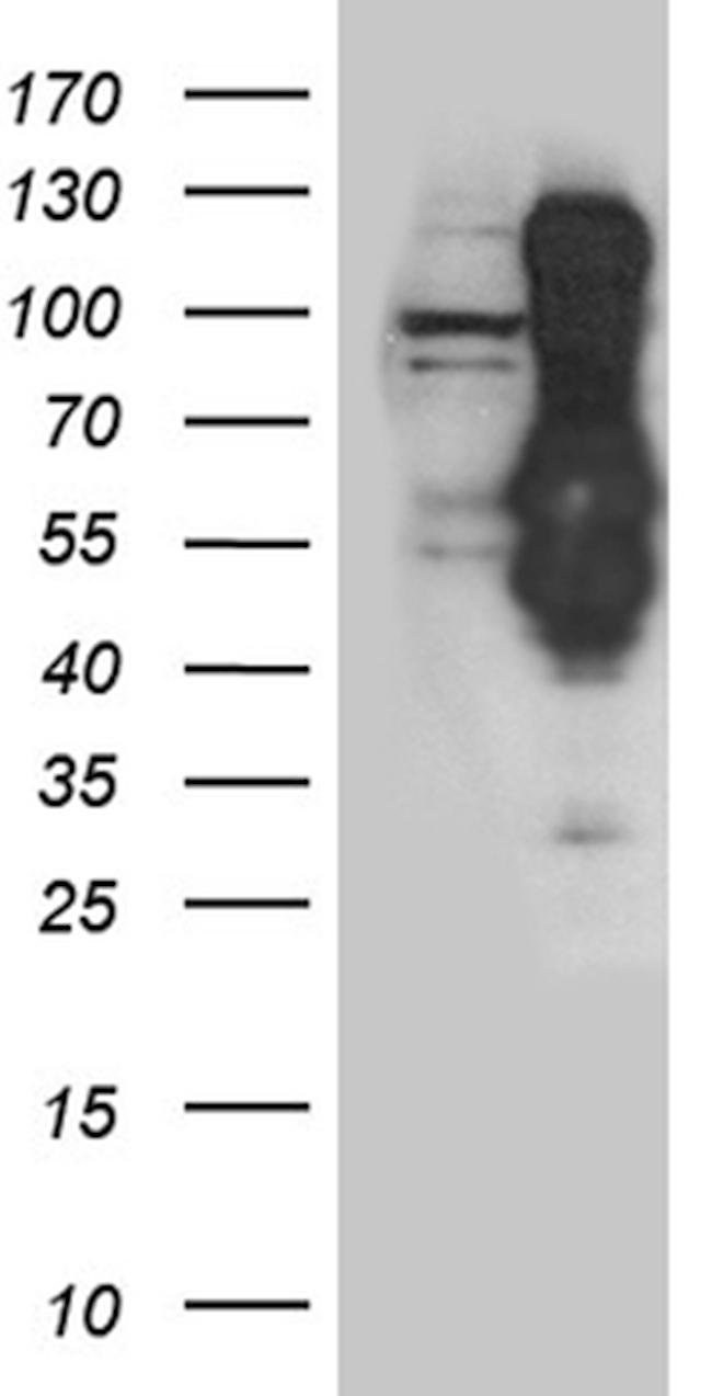 INCENP Antibody in Western Blot (WB)
