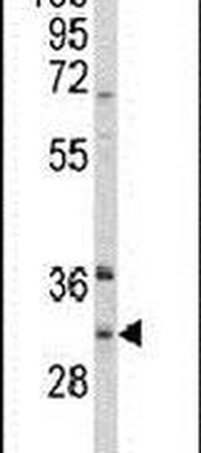 ING5 Antibody in Western Blot (WB)