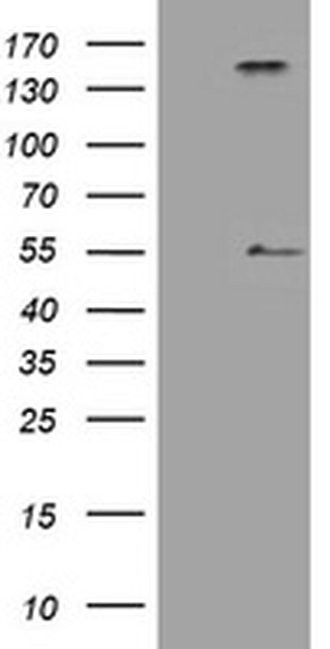 INHA Antibody in Western Blot (WB)