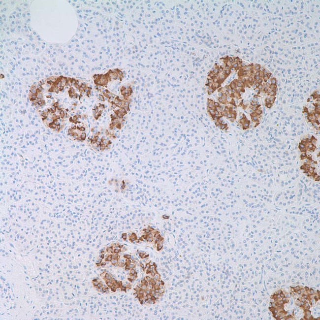Insulin Antibody in Immunohistochemistry (IHC)