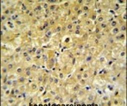 INSC Antibody in Immunohistochemistry (IHC)