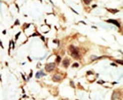 INSR Antibody in Immunohistochemistry (IHC)