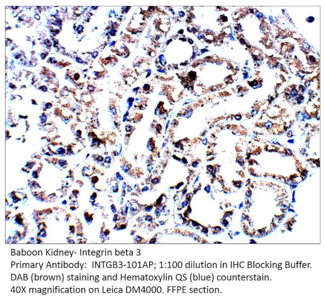 Integrin beta 3 Antibody in Immunohistochemistry (IHC)
