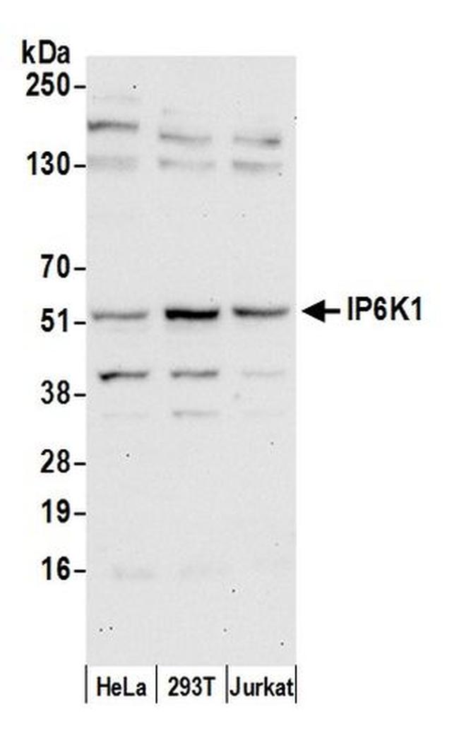 IP6K1 Antibody in Western Blot (WB)