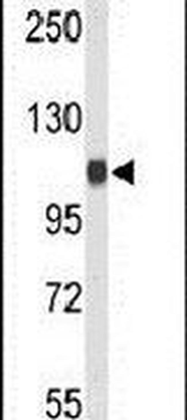 Importin 11 Antibody in Western Blot (WB)