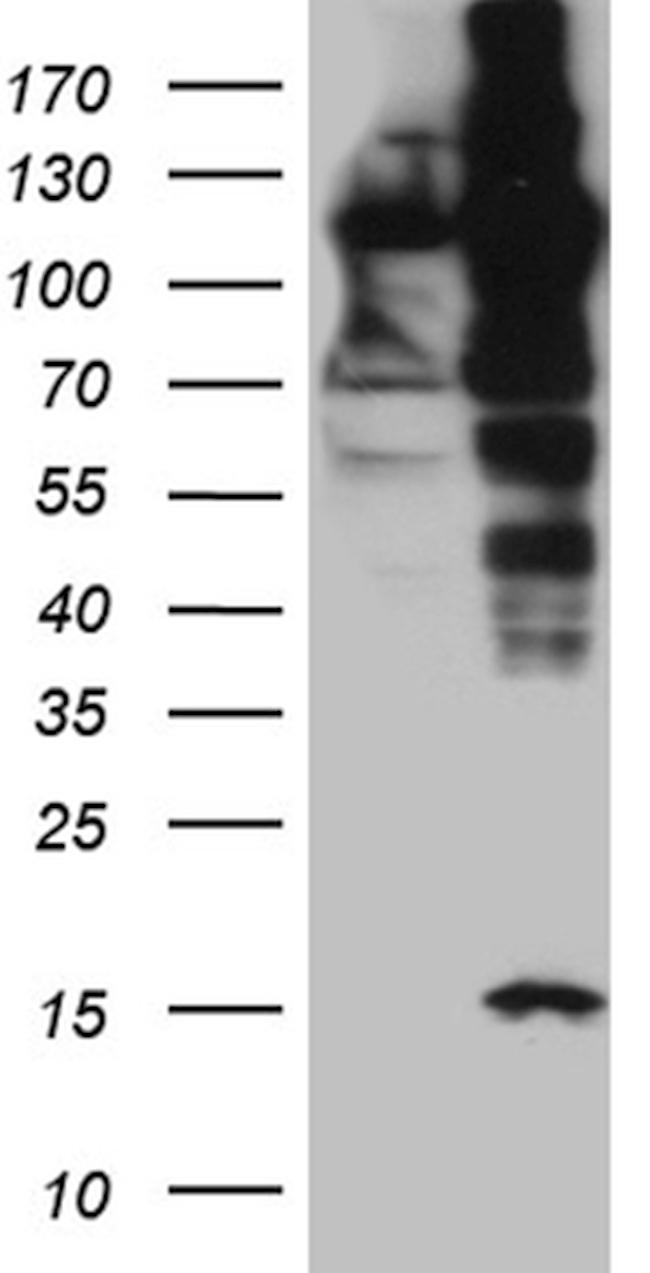 IPO5 Antibody in Western Blot (WB)