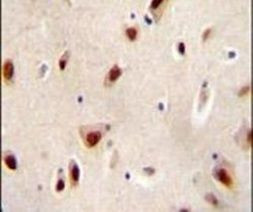 IQCJ Antibody in Immunohistochemistry (IHC)