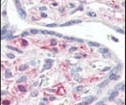 IRAK1 Antibody in Immunohistochemistry (IHC)