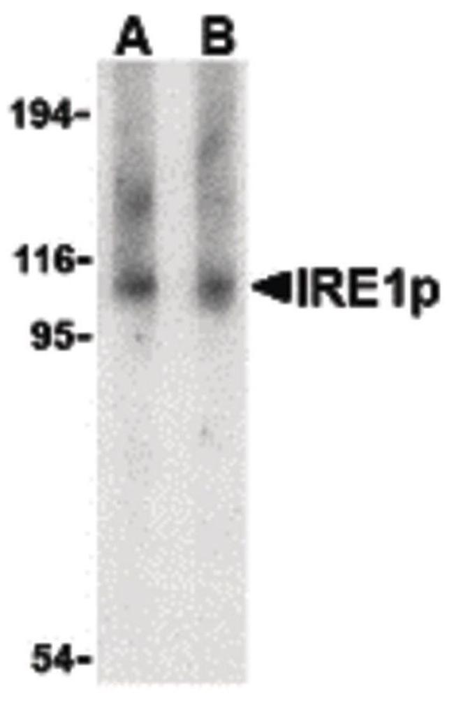 IRE1 alpha Antibody in Western Blot (WB)