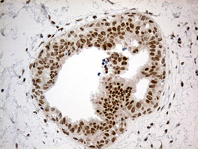 IRF2BP1 Antibody in Immunohistochemistry (Paraffin) (IHC (P))
