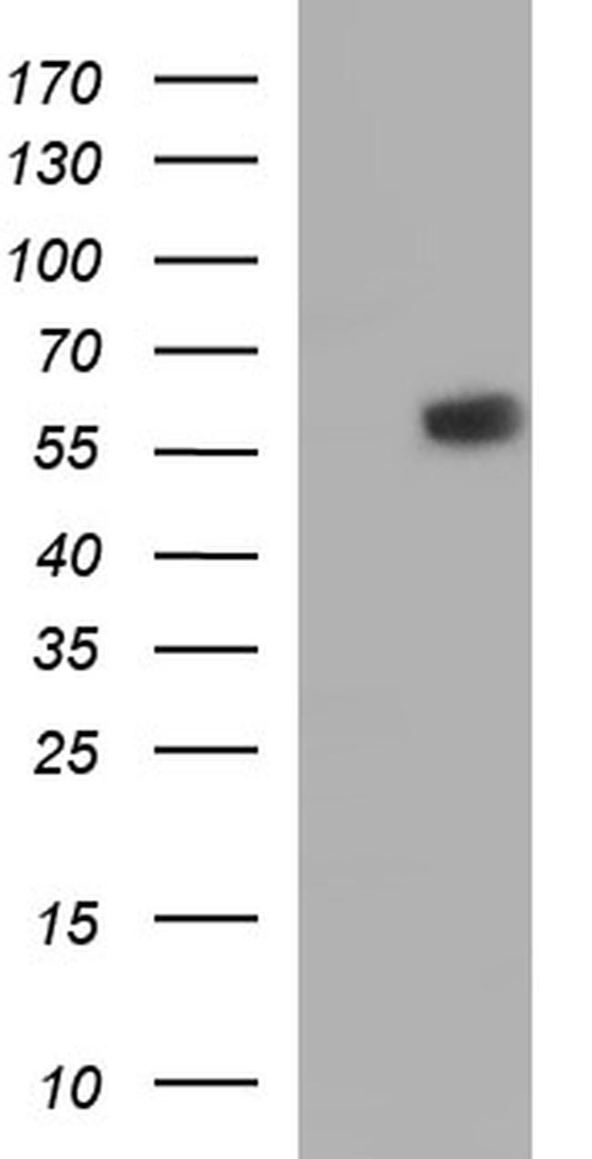 IRF5 Antibody in Western Blot (WB)