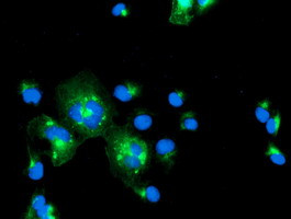 IRF6 Antibody in Immunocytochemistry (ICC/IF)